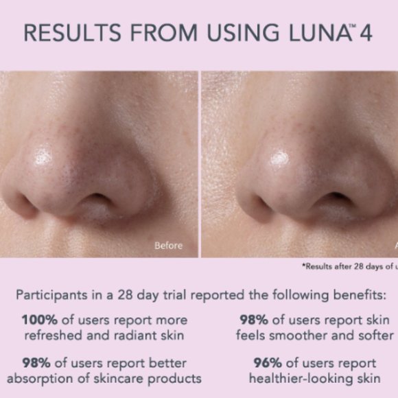 FOREO LUNA 4 - 2 IN 1 SMART CLEANSING FACIAL DEVICE -SENSITIVE SKIN- LILAC - Picture 2 of 3